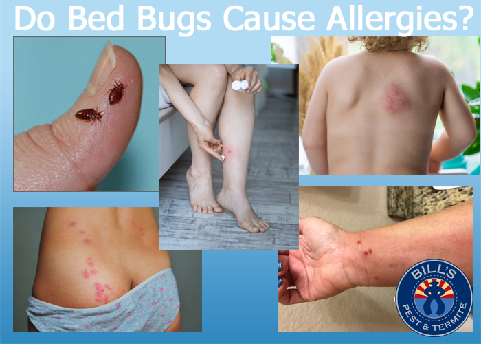 Do Bed Bugs Cause Allergies? Understanding the Impact of Bed Bug Infestations